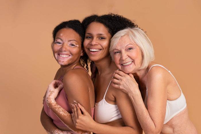 Embracing Imperfections: Celebrate Your Unique Beauty